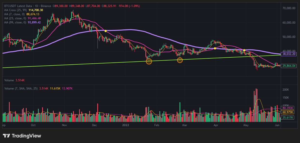 오른쪽 엉덩이가 더 높은 쌍바닥
